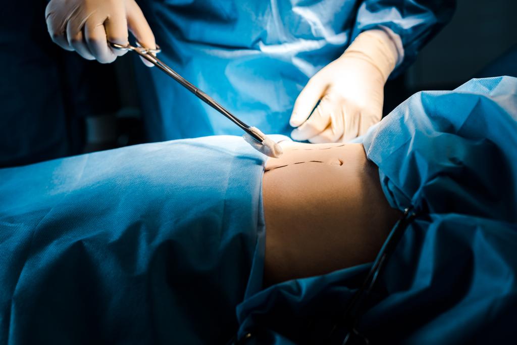 手術をしてタンポンを握る外科医のクロップドビュー ロイヤリティフリー写真 画像素材