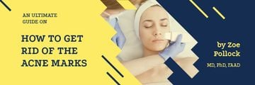 Acne Treatment with Woman at Beauty Procedure